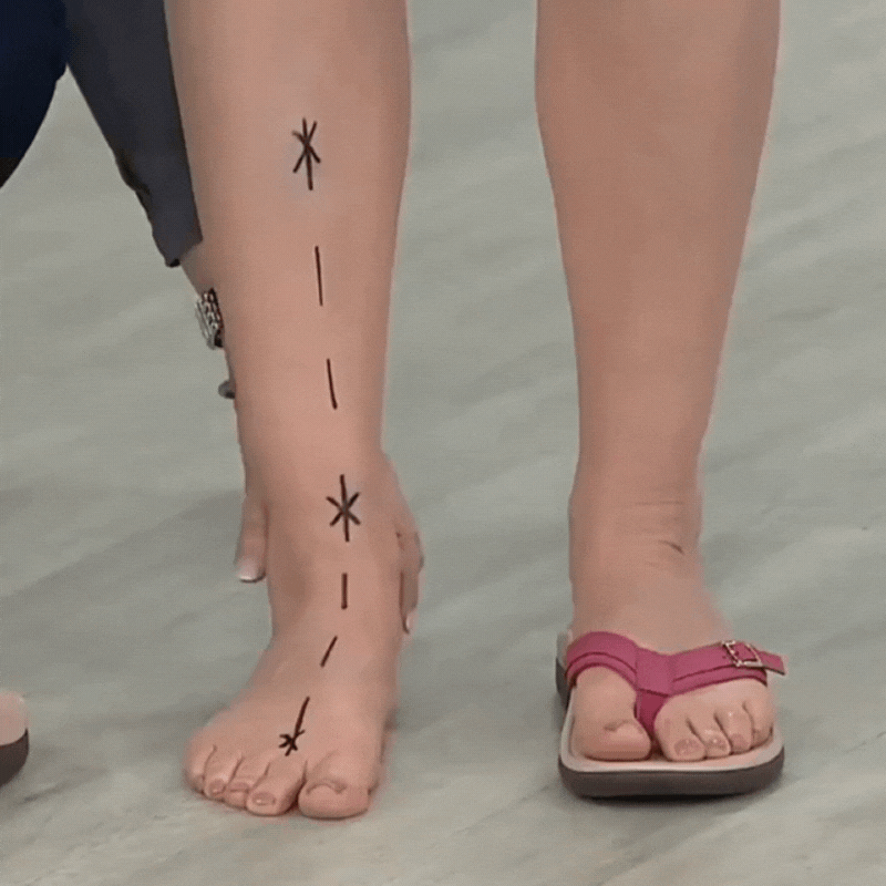 Feetz® | Orthopedische Sandalen